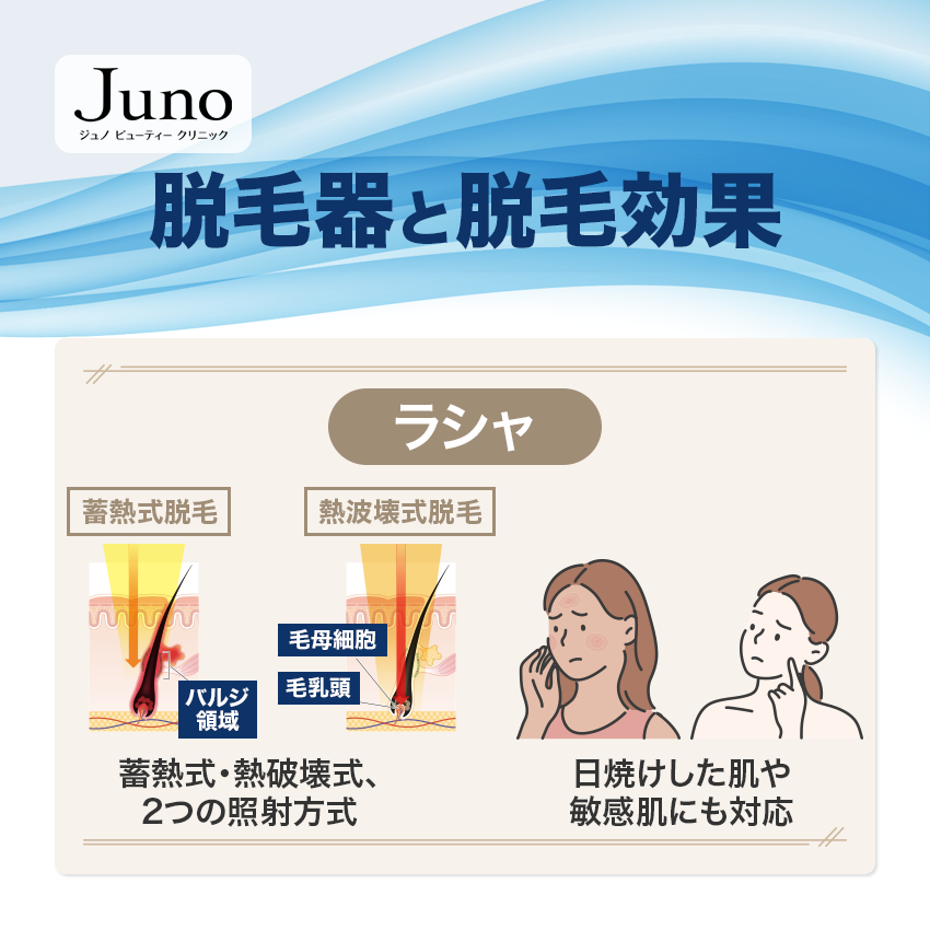 ジュノビューティークリニックの脱毛器と脱毛効果